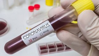 Azərbaycanda son həftədə 17 nəfər koronavirusa yoluxub, 1-i ölüb