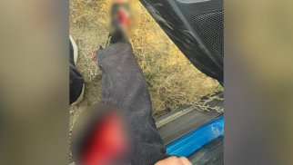 
AzTV-nin müxbiri təyyarənin qəzaya düşdüyü ərazidə yaralandı- FOTO