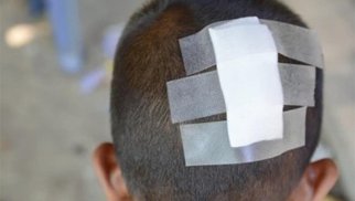 
Hesaba görə kafe sahibi ilə mübahisə etdi, 6 yaşlı oğlu başından zərbə aldı